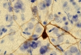 Biocytin labeled neuron from the rat striatum.