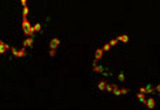 Drosophila Larval neuromuscular junction.