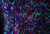 Confocal image of a coronal section through a mouse hypothalamus showing axons from the arcuate nucleus (red fluorescence) innervating the paraventricular nucleus. These axons contain various neuropeptides involved in feeding and metabolism such as the anorexigenic neuropeptide alpha-MSH (green fluorescence) and the orexigenic neuropeptide beta-endorphin (blue fluorescence). These neural projections are known to convey signals from the adipocyte-derived hormone leptin to the paraventricular nucleus, which functions to regulate food intake and body weight throughout life.