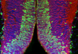 Neuron proliferation in the embyonic hypothalamus. Both perinatal hormones (such as leptin) and nutrition appear to influence this biological process. This confocal image shows newly generated BrdU-positive cells (green fluorescence) in the neuroepithelium of an E12.5 embryo. Nuclei are depicted in blue, nestin-positive cell progenitors are shown in red.