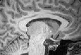 Dr. Kutch's Brain.