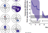 Development and Retention of Rereferenced Saccades Measured by the First Saccade Landing Site (A) Probability density maps of the retinal position of a target object at the completion of the first saccade after target movement (same format as in
Figure 2A). (B) Variance (BCEA) of the first saccade landing site as a function of block number (same format as in Figure 2B). The first saccade landing site after each target movement was near the fixational PRL and distant from the fovea. Similar to the fixational PRL, the variance of the first saccade landing sites decreased rapidly within a short period of time without explicit training, demonstrating a spontaneous shift in oculomotor reference from the fovea to the PRL. With explicit training, the BCEA was further reduced to the normal range of intact foveal vision. (From Kwon, Nandy & Tjan, 2013, Current Biology)