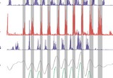 In the chick, control of leg movements for locomotion emerges during embryonic development. The muscle activity and limb excursions for these coordinated movements can be recorded during spontaneous activity (motility) in the egg. This figure is a typical example of EMG and joint kinematic recordings during spontaneous repetitive leg movements in a chick at embryonic day 20. Upward excursions in the kinematic traces indicate extension of the hip, knee and ankle joints during the EMG traces for muscle activity in the same leg.