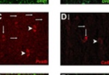 Confocal images of fluorescent in situ hybridization for Drd1, Pvalb and Calb1