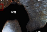 Darkfield image of GLP-1 immunoreactivity at the interventricular foramen