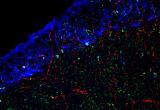 Confocal image of tri-label immunohistochemistry at the ventricular ependyma