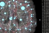 Autism and Brain Networks