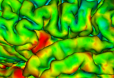 A map of cortical thickness.