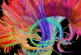 A sagittal view of white matter fiber tracts in the living brain