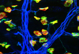 Neuromuscular junctions in a mammalian hindlimb muscle. NMJs are triple-labeled to reveal axons (blue), presynaptic nerve terminals (green), and postsynaptic acetylcholine receptors (red).