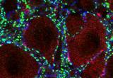 Triple staining of spinal motoneurons (red) and synapses (blue and green) in the ventral horn of the spinal cords of SMA mutant mice.
