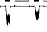 The taste channel TRPM5 is activated by micromolar concentrations of Ca2+. Activation by 40 mM Ca2+ of an inward current in a patch excised from a TRPM5-transfected CHO-K1 cell (Vm = 80 mV). Neither 10 mM IP3 nor 100 mM OAG nor 10 mM PIP2 elicited a current in the same patch. (Modified from Liu and Liman, PNAS, 2003).