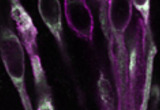 Expression of the TRPM5 ion channel in taste cells (unpublished). Taste buds from mouse circumvallate papillae were labeled with anti-TRPM5 (purple) and anti-PLCb2 (green) antibodies. Co-localization is shown in white.
