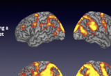 Univariate BOLD signal in normal older adults during pro-saccades (top) in contrast to greater BOLD signal during anti-saccades (bottom).