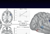 Increased functional connectivity between key cognitive regions for executive function and memory after a 12-week donepezil intervention in individuals with mild cognitive impairment.