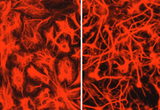 Primary cultures of rat astrocytes develop a reactive phenotype (evidenced here with a process-bearing morphology) when treated with beta-amyloid, the protein implicated in neurodegenerative cascades of Alzheimer's disease. Cultures were immunostained with GFAP (red).