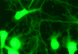 Primary culture of rat hippocampal neurons stained with the fluorescent vital dye calcein AM. Note the presence of numerous, finely branched neurites.