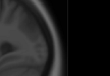 Cluster indicating less grey matter in medial temporal lobe associated with susceptibility to scams (Han et al., in press, Brain Imaging and Behavior)