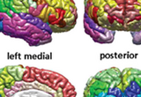 Automatic parcellation of the cerebral cortex obtained from magnetic resonance imaging subsequent to tissue classification. The surface of each lobe is drawn using a different color scheme, and a different color is used for each gyrus and sulcus.