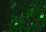 Trigeminal ganglia section demonstrating expression of a GFP transgene in cold-sensing, TRPM8 neurons.