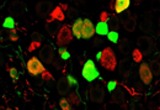 Labeling of neurons expressing TRPM8 (green) and TRPV1 (red) in mouse dorsal root ganglia.