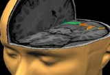 3-D cut-away view of brain activation during word and pseudoword reading