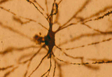 Striatal medium spiny neuron