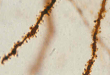 spines from medium spiny neuron
