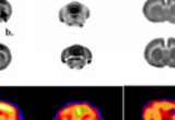 Functional brain activation during treadmill walking in the rat. Autoradiography and microPET