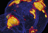 Activated regions of the cortex, subcortex, and midline cerebellum of a rat walking on a treadmill