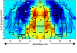 Z-score Maps of regional cerebral blood flow in the flattened rat cortex during locomotor challenge