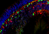 Bipolar cell dendrites (green) coexist with horizontal cells and their processes (red) along the outer plexiform layer.