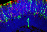 Section of a human retinal organoid with rod (red) and cone (green) photoreceptors aligned along the photoreceptor layer.