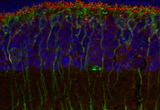 Retina's first image. Rod bipolar cells are labeled green and their receptors on their dendrites are labeled red.
