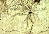 Golgi-stained Striatal Medium Spiny Neuron from Mouse Brain.