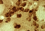 Medium Spiny Neuron from Mouse Striatum Expressing a Phosphorylated Form of NMDA Glutamate Receptor