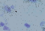In situ Hybridization Analysis of Tyrosine Hydroxylase mRNA in Mouse Midbrain Nigrostriatal Neurons.
