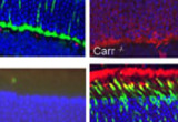 Morphology and Expression of Arrestin1 and Cone Arrestin in Knockout Mice Retinas in Cone Photoreceptors with Dual Immunocytochemistry (Green = LUMIj, Red =Arr1, Blue=DAPI).