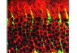 Immunocytochemistry of visual arrestins in rods and cones. Both Arrestin1 and Cone Arrestin immunoreactive proteins identified with LUMINAIRE antibodies are distributed throughout the cones.